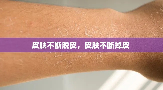 皮肤不断脱皮,皮肤不断掉皮