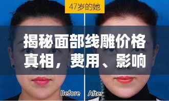 揭秘面部线雕价格真相,费用、影响因素全解析!